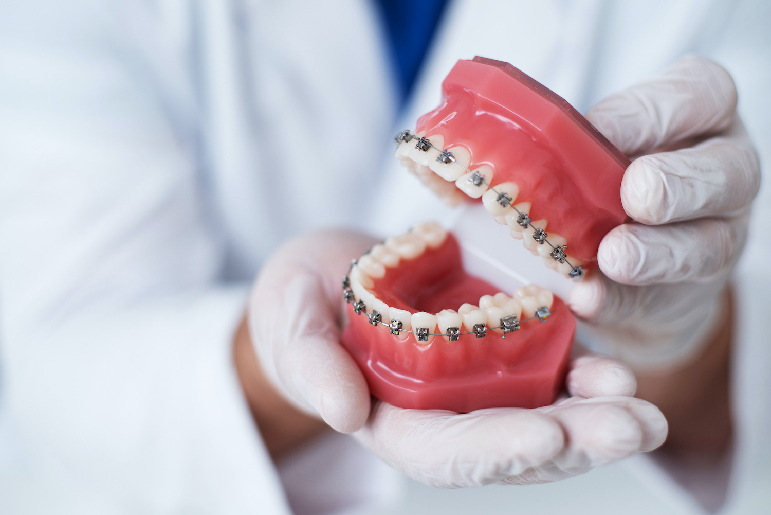 An orthodontist holds a model of teeth with braces